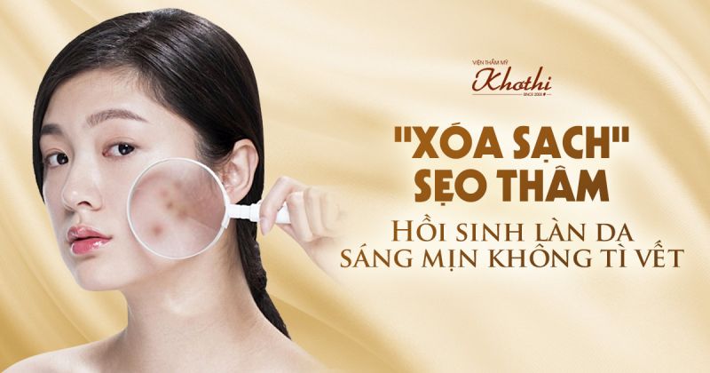 Điều trị sẹo thâm
